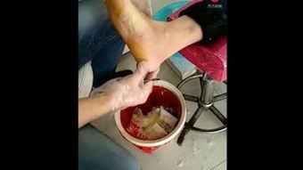 修脚入门视频,跟随视频轻松掌握专业修脚技巧